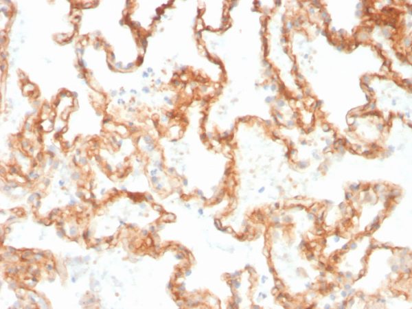 Formalin-fixed, paraffin-embedded human Lung stained with CD29 Mouse Monoclonal Antibody (ITGB1/3613).