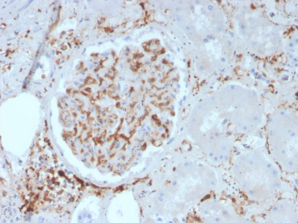 Formalin-fixed, paraffin-embedded human kidney stained with CD29 Mouse Monoclonal Antibody (ITGB1/3613).