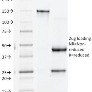 SDS-PAGE Analysis Purified CD61 Monoclonal Antibody (Y2/51). Confirmation of Purity and Integrity of Antibody.