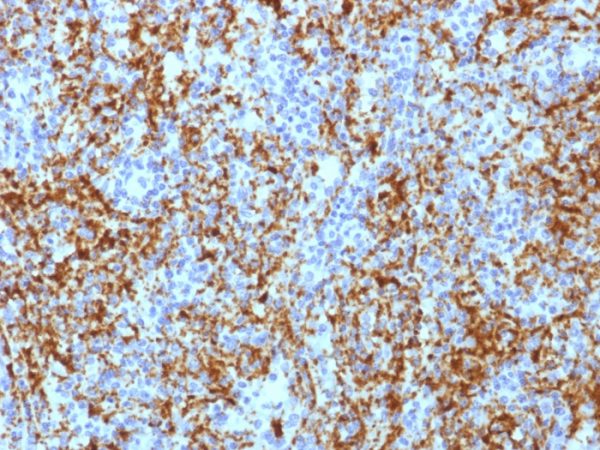 Formalin-fixed, paraffin-embedded human Spleen stained with CD61 Mouse Monoclonal Antibody (ITGB3/1713).
