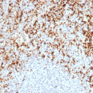 Formalin-fixed, paraffin-embedded human Spleen stained with CD61 Mouse Monoclonal Antibody (ITGB3/2597).