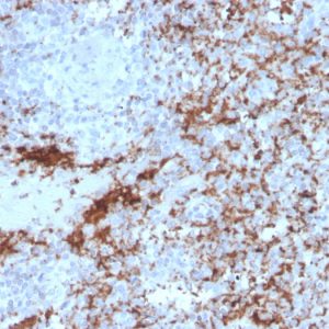 Formalin-fixed, paraffin-embedded human spleen stained with CD61 Recombinant Mouse Monoclonal Antibody (rITGB3/2145).