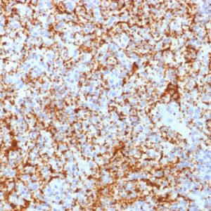 Formalin-fixed, paraffin-embedded human Spleen stained with CD61 Rabbit Recombinant Monoclonal Antibody (ITGB3/2166R).