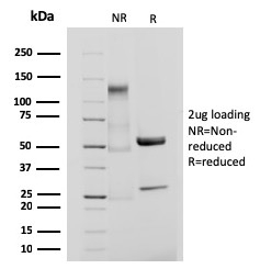 SDS-PAGE Analysis Purified CD61 Recombinant Rabbit Monoclonal Antibody (ITGB3/3126R). Confirmation of Purity and Integrity of Antibody.