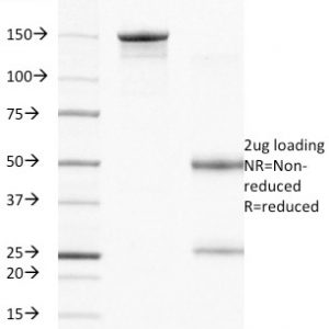 SDS-PAGE Analysis of Purified CD104 Mouse Monoclonal Antibody (UMA9). Confirmation of Integrity and Purity of Antibody