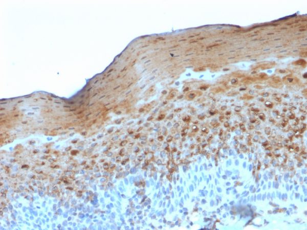 Formalin-fixed, paraffin-embedded human Tonsil stained with Involucrin Mouse Monoclonal Antibody (SY5).