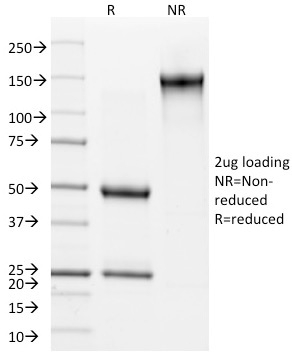 SDS-PAGE Analysis of Purified Involucrin Mouse Monoclonal Antibody (SY5). Confirmation of Purity and Integrity of Antibody.