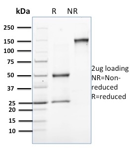 SDS-PAGE Analysis of Purified Involucrin Mouse Monoclonal Antibody (SPM259). Confirmation of Purity and Integrity of Antibody.
