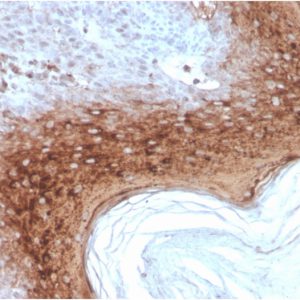 Formalin-fixed, paraffin-embedded human Skin stained with Involucrin Mouse Recombinant Monoclonal Antibody (rIVRN/827).