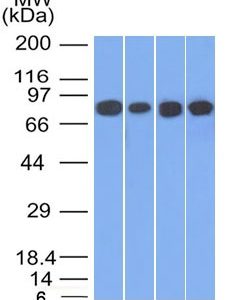 Western Blot of HT20, A549, 293 and A431 cell lysates using C Catenin, gamma Mouse Monoclonal Antibody (11E4).