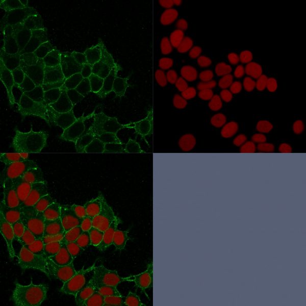 Confocal immunofluorescence image of HeLa cells using Catenin, gamma Mouse Monoclonal Antibody (11E4) Green (CF488) and Reddot is used to label the nuclei Red.