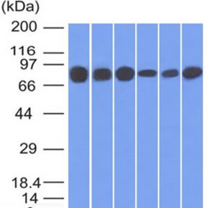 Western blot analysis: HT20, 293, A431, MCF-7, HepG2 & A549 cell lysates  using Catenin, gamma Mouse Monoclonal Antibody (15F11).