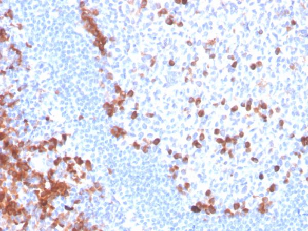 Formalin-fixed, paraffin-embedded human tonsil stained with B7-H6 / NCR3LG1 Mouse Monoclonal Antibody (B7H6/4821).