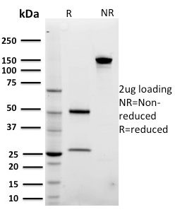 SDS-PAGE Analysis Purified ARF1 Mouse Monoclonal Antibody (3F1). Confirmation of Integrity and Purity of the Antibody.