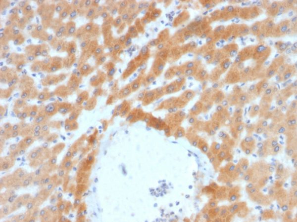 Formalin-fixed, paraffin-embedded human Liver stained with ARF1 Mouse Monoclonal Antibody (ARF1/2117).
