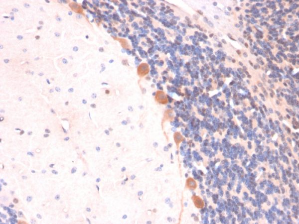 Formalin-fixed, paraffin-embedded Rat Brain stained with ARF1 Mouse Monoclonal Antibody (ARF1/2117).