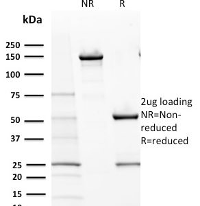 SDS-PAGE Analysis Purified CD117 Mouse Monoclonal Antibody (KIT/2670). Confirmation of Purity and Integrity of Antibody.