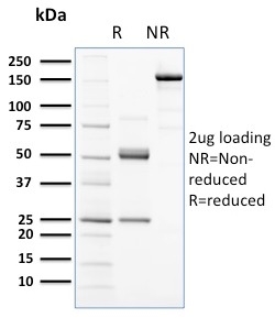 SDS-PAGE Analysis Purified CD117 Mouse Monoclonal Antibody (KIT/2672). Confirmation of Purity and Integrity of Antibody.