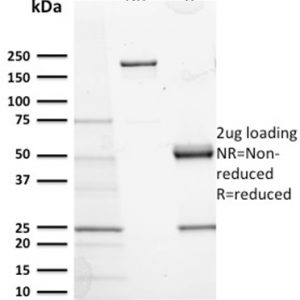 SDS-PAGE Analysis Purified CD117 Mouse Monoclonal Antibody (KIT/2673). Confirmation of Purity and Integrity of Antibody.
