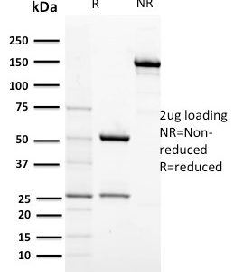SDS-PAGE Analysis Purified CD117 Mouse Monoclonal Antibody (KIT/2674). Confirmation of Purity and Integrity of Antibody.