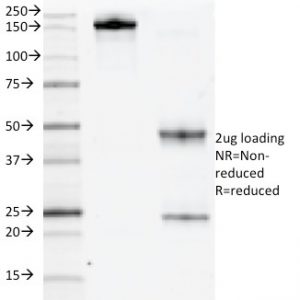 CD117 / c-Kit (Marker for Gastrointestinal Stromal Tumors) Antibody