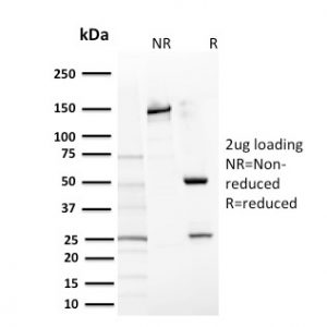 SDS-PAGE Analysis Purified CD117 Mouse Monoclonal Antibody (KIT/2669). Confirmation of Purity and Integrity of Antibody.
