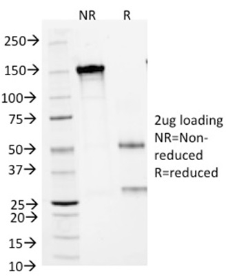 SDS-PAGE Analysis of Purified ARG1Mouse Monoclonal Antibody (ARG1/1125). Confirmation of Integrity and Purity of Antibody.