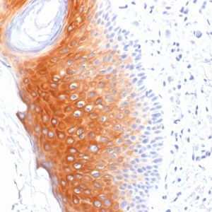 Formalin-fixed, paraffin-embedded human Skin stained with Cytokeratin 1 Mouse Monoclonal Antibody (LHK1).