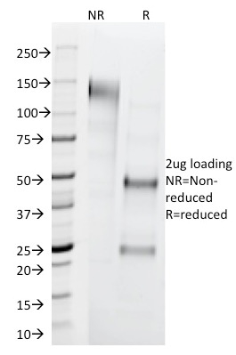 SDS-PAGE Analysis of Purified Cytokeratin 1 Mouse Monoclonal Antibody (LHK1). Confirmation of Integrity and Purity of Antibody.