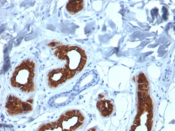 Formalin-fixed, paraffin-embedded human Skin stained with Cytokeratin 3 Mouse Monoclonal Antibody (KRT3/2130).
