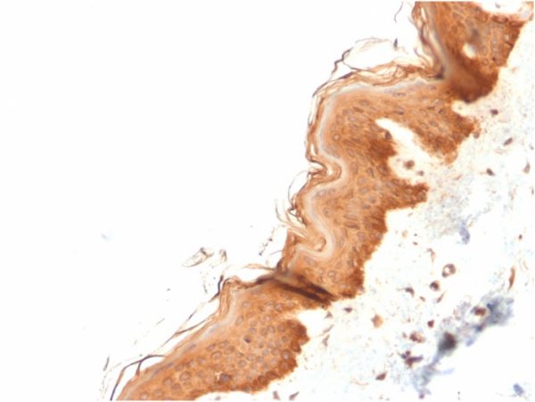 Formalin-fixed, paraffin-embedded human Skin stained with Cytokeratin 4 Mouse Monoclonal Antibody (KRT4/2804).