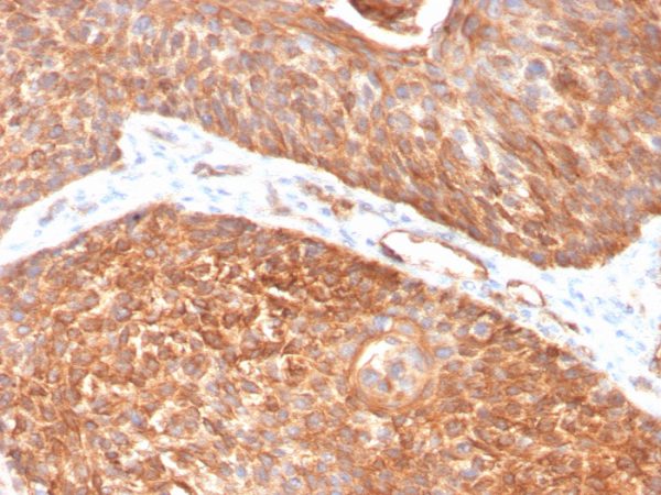 Formalin-fixed, paraffin-embedded human pancreas stained with Cytokeratin 5 Mouse Monoclonal Antibody (KRT5/3594).