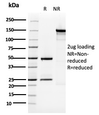 SDS-PAGE Analysis Purified Cytokeratin 5 Mouse Monoclonal Antibody (KRT5/3594). Confirmation of Purity and Integrity of Antibody