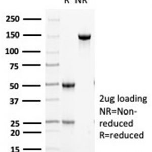SDS-PAGE Analysis of Purified Cytokeratin 5 Mouse Monoclonal Antibody (KRT5/6466). Confirmation of Purity and Integrity of Antibody.