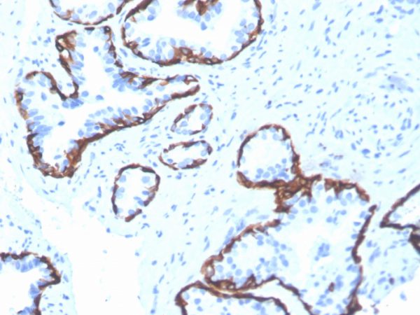 Formalin-fixed, paraffin-embedded human prostate stained with Cytokeratin 5 Recombinant Mouse Monoclonal Antibody (rKRT5/6398).
