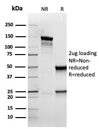 SDS-PAGE Analysis Purified KRT5 Recombinant Mouse Monoclonal Antibody (rKRT5/6398). Confirmation of Purity and Integrity of Antibody