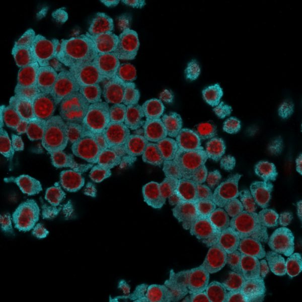 Immunofluorescence Analysis of RAW cells labeling KRT6 with KRT6 Mouse Monoclonal Antibody (SPM269) followed by Goat anti-Mouse IgG-CF488 (Cyan). The nuclear counterstain is Reddot (Red).