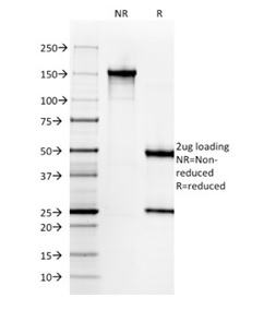 SDS-PAGE Analysis Purified Cytokeratin 6A Mouse Monoclonal Antibody (KRT6A/2368). Confirmation of Integrity and Purity of Antibody.