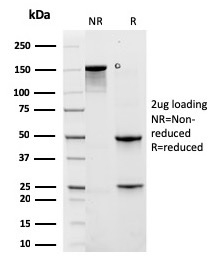 SDS-PAGE Analysis Purified KRT6A Recombinant Mouse Monoclonal Antibody (rKRT6A/2100). Confirmation of Purity and Integrity of Antibody.