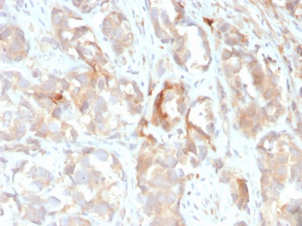 Formalin-fixed, paraffin-embedded human prostate stained with Cytokeratin 6B (KRT6B) Monoclonal Antibody (KRT6B/2116).