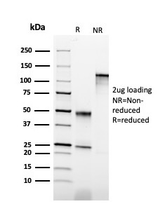 SDS-PAGE Analysis Purified Cytokeratin 6B (KRT6B) Monoclonal Antibody (KRT6B/2116). Confirmation of Purity and Integrity of Antibody.