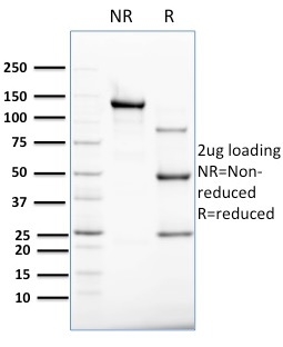 SDS-PAGE AnalysisPurified Cytokeratin 8 Mouse Monoclonal Antibody (B22.1). Confirmation of Purity and Integrity of Antibody Cytokeratin 8 (KRT8) Antibody - Image 2