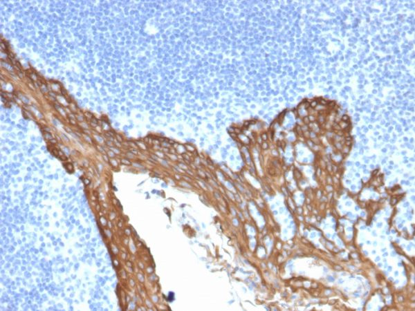 Formalin-fixed, paraffin-embedded human Prostate stained with Cytokeratin 8 Mouse Monoclonal Antibody (KRT8/2115).
