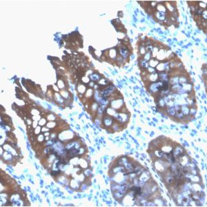Formalin-fixed, paraffin-embedded human Colon stained with Cytokeratin 8 Mouse Recombinant Monoclonal Antibody (rB22.1).