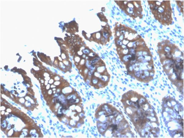 Formalin-fixed, paraffin-embedded human Colon stained with Cytokeratin 8 Mouse Recombinant Monoclonal Antibody (rB22.1).