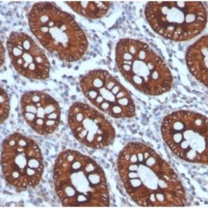 Formalin-fixed, paraffin-embedded human colonstained with Cytokeratin 8 Mouse Monoclonal Antibody (KRT8/4006).
