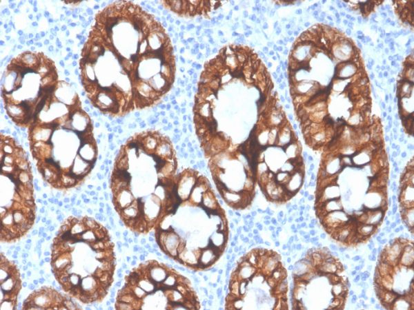 Formalin-fixed, paraffin-embedded human colon stained with Cytokeratin 8 Recombinant Mouse Monoclonal Antibody (rKRT8/4209).