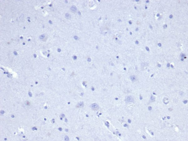IHC analysis of formalin-fixed, paraffin-embedded human brain. Negative tissue control using rKRT8/4209 at 2ug/ml in PBS for 30min RT. HIER: Tris/EDTA, pH9.0, 45min. 2°C: HRP-polymer, 30min. DAB, 5min.