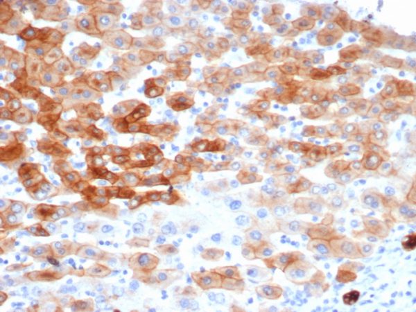 Formalin-fixed, paraffin-embedded human colon stained with Cytokeratin 8 Recombinant Mouse Monoclonal Antibody (rKRT8/6471).