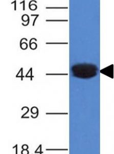 Western Blot Analysis of A431 cell lysate using Cytokeratin 8 Mouse Monoclonal Antibody (K8/383).